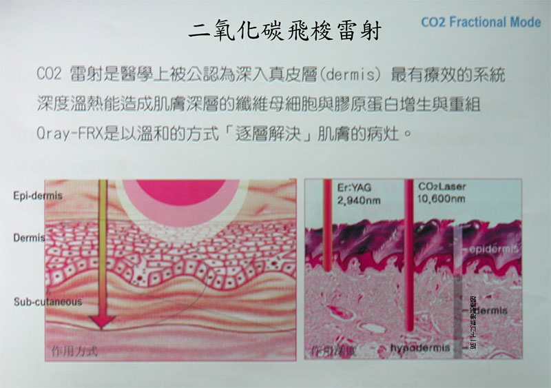 1479455115795369.jpg 2.jpg