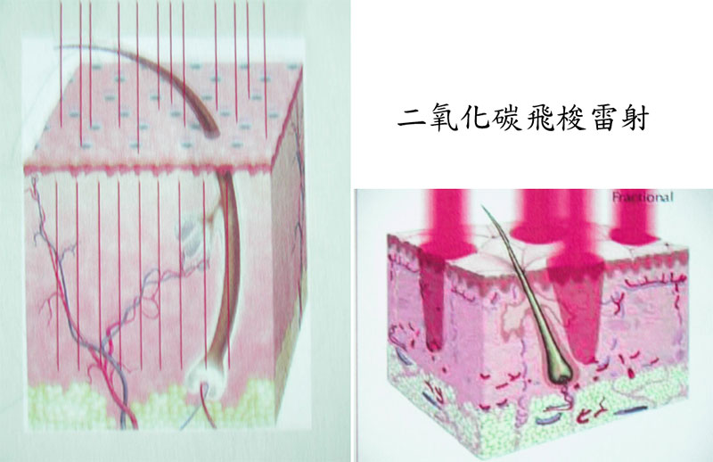 1479455125276511.jpg 3.jpg